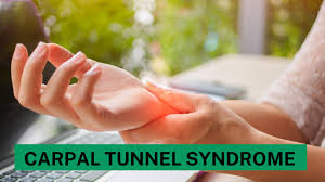 Strategies for reducing from Carpal Tunnel Syndrome