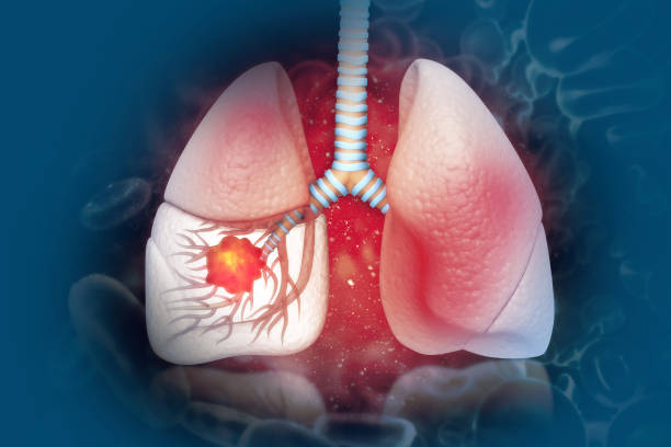 How can I alleviate my asthma symptoms the most effectively?