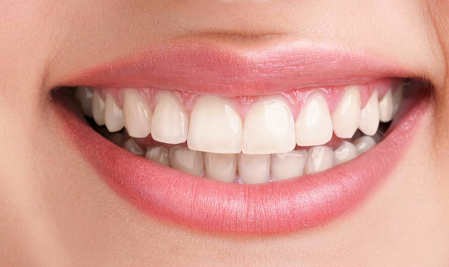 Is The Dentist In Houston The Solution For Brighter Smiles?