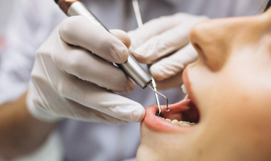 Is Oral Cancer Screening At A Dentist Office In Houston