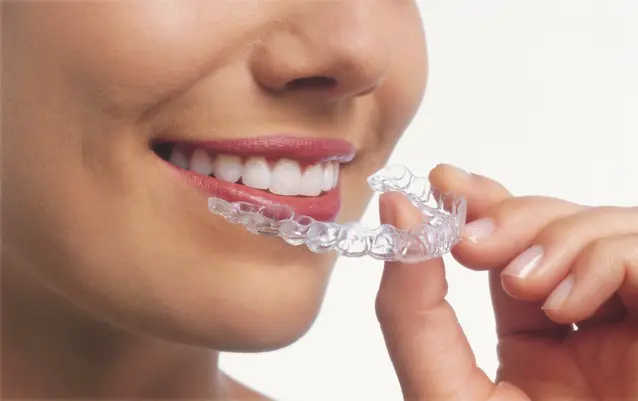 invisalign : How To Get Braces When You Don’t Need Them?